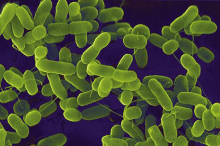 E. coli protrūkio paslaptis gilėja - Pasaulyje