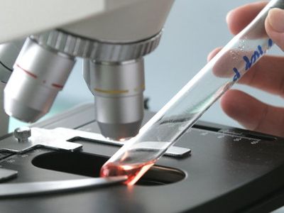 Поразившую европейцев кишечную инфекцию связали с семенами из Египта
                 - Наука и здоровье