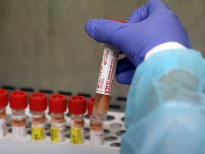 В воскресенье вечером установлены 14 новых случаев коронавируса (дополнено) - Литва и страны Балтии