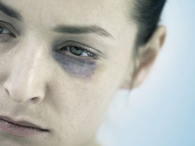 В Висагинасе пройдет акция «16 дней против насилия над женщинами»                                                                                      - В Висагинасе