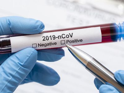 Подтверждено 9 новых случаев заражения COVID-19 - Литва и страны Балтии
